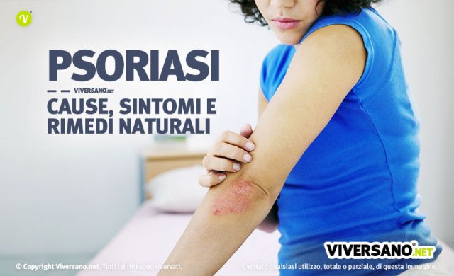 Psoriasi Cause Sintomi E 10 Rimedi Naturali Efficaci