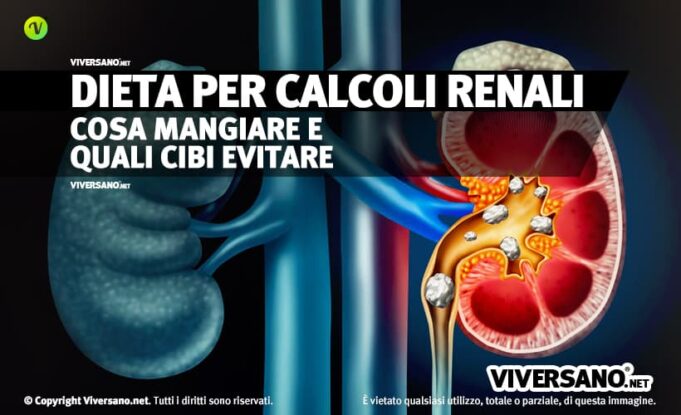 Calcoli Renali Le Cause I Sintomi E I Cibi Da Evitare Porn Sex Picture