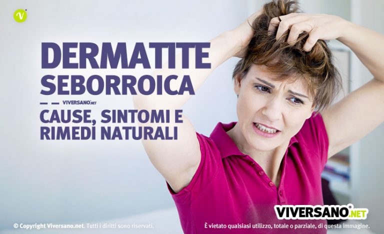 Dermatite Seborroica Sintomi Cause Rimedi Naturali E Consigli Alimentari